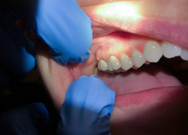 Best Emergency Treatment for Jaw Pain or Injury in Tieton, WA